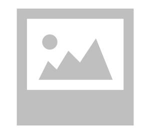 Un Guyanais neutralisé et grave blessé par balle par la police après une agression au couteau à Paris